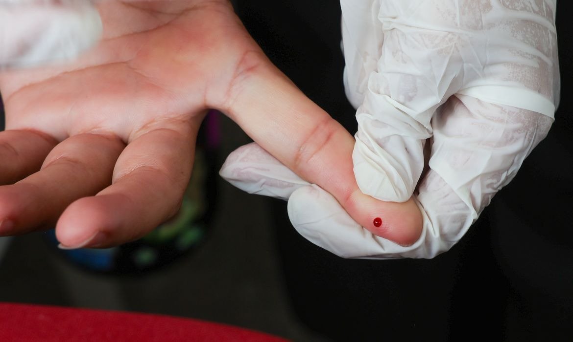 Brasil alcança avanço na saúde e busca eliminar transmissão da hepatite B