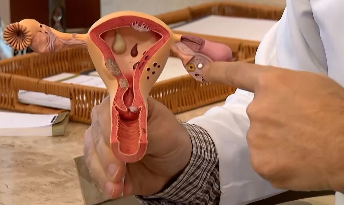 CNPq abre edital de R$ 60 milhões para pesquisas sobre endometriose no SUS